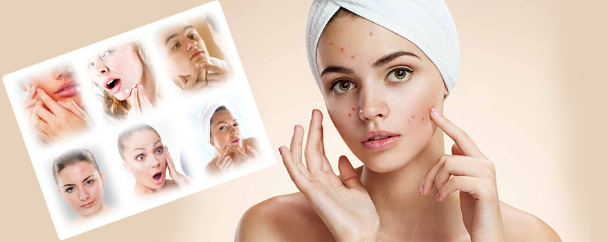 Get rid of acne and scars at instasculpt