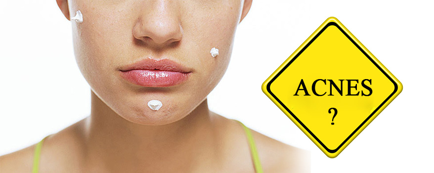 How to get rid of Acne