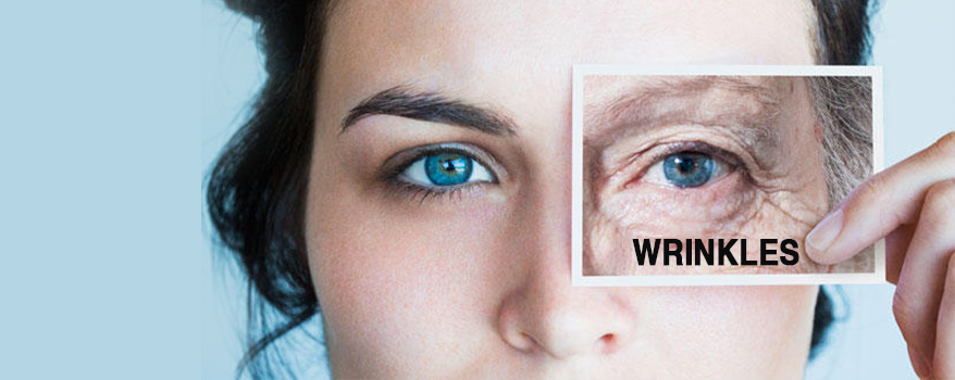 What are the causes of Wrinkles